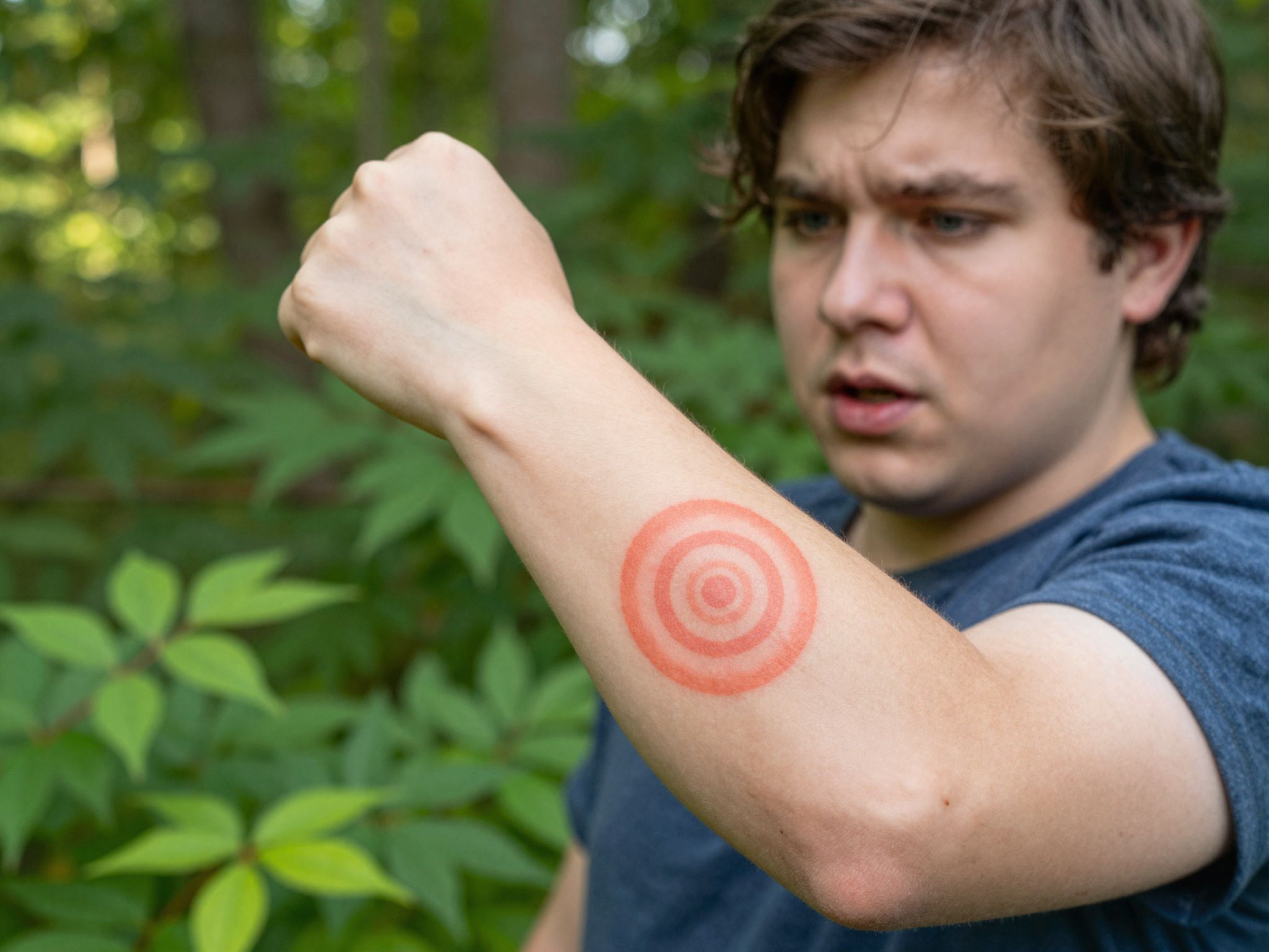 A krónikus Lyme-kór gyakran aluldiagnosztizált és félreértett betegség.