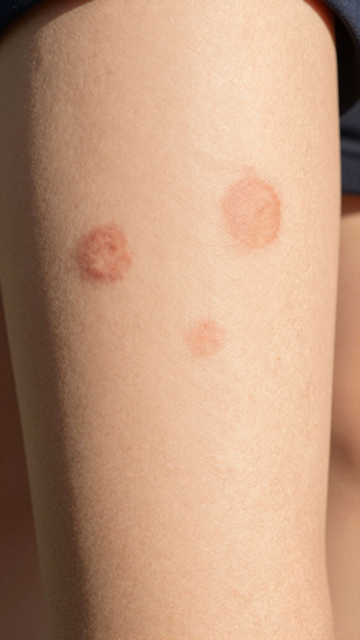 A tartós bőrelváltozások orvosi kivizsgálást igényelnek.