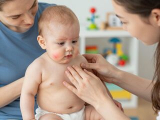 Mit kell tudni a csecsemőkori tejótvarról és hogyan szabadulj meg tőle gyorsan?
