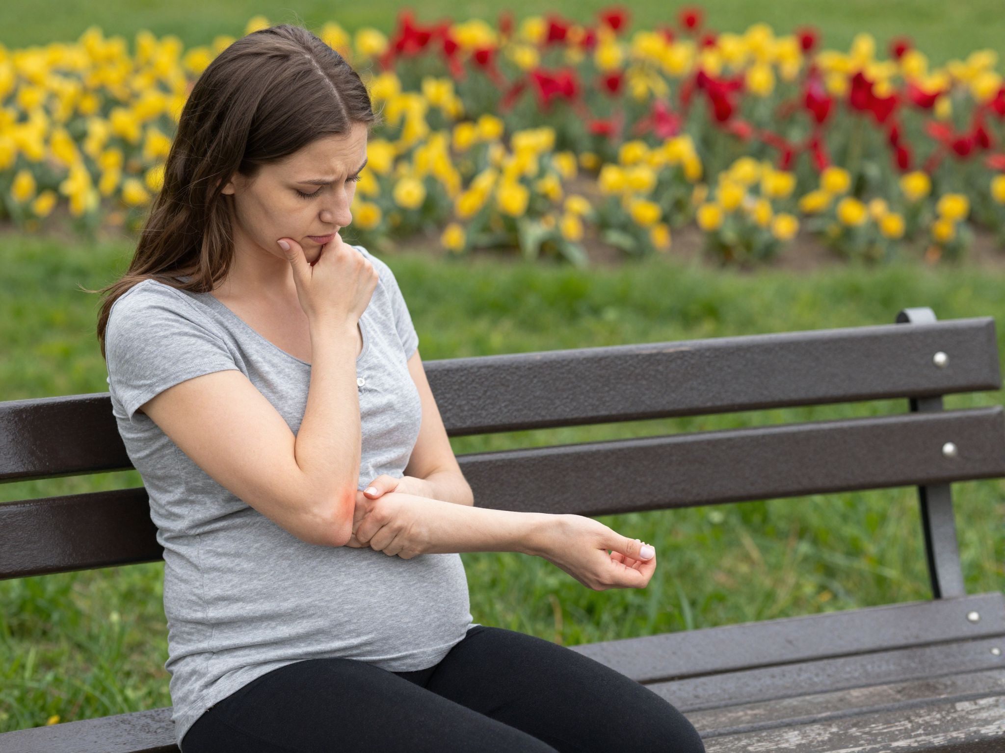 A terhességi ekcéma gyakran viszketéssel és bőrpírral jár.