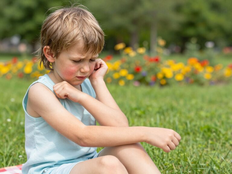 Nyári bőrproblémák gyerekeknél: a melegkiütés és napallergia tünetei és kezelése