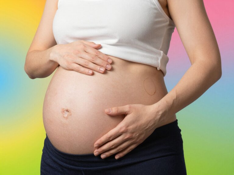 Bőrelváltozások terhesség alatt: a májfoltok, tűzfoltok és egyéb pigmentációs problémák