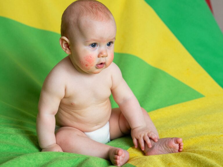 Apró piros pöttyök a baba bőrén? Minden, amit a melegkiütésről tudni kell