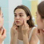 Babakori akné vagy tejkiütés? Így különböztetheted meg a pattanáshoz hasonló pöttyöket