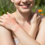 Pánikra semmi ok: a melegkiütés ártalmatlan, de kellemetlen bőrprobléma