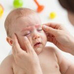 A csecsemőkori könnycsatorna-elzáródás masszírozása lépésről lépésre