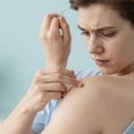 Mikor kell orvoshoz fordulni az anyajegyeiddel? Az ABCDE szabály és a legfontosabb tudnivalók